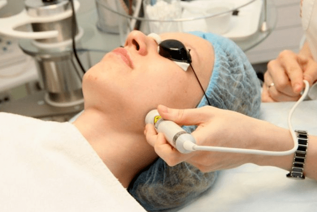 Biorewitalizacja laserowa